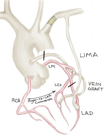 the anatomy of the heart and its major vessels, including the ventrical artery