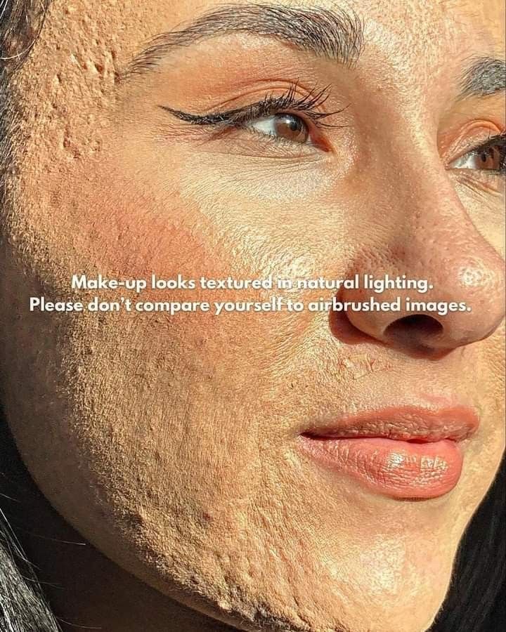 Real Makeup Texture, Real Skin Texture Makeup, Girl With Acne, Acne Positivity, Heat Rash, Real Bodies, Cute Tumblr Pictures, Indian Makeup, Remove Dark Spots