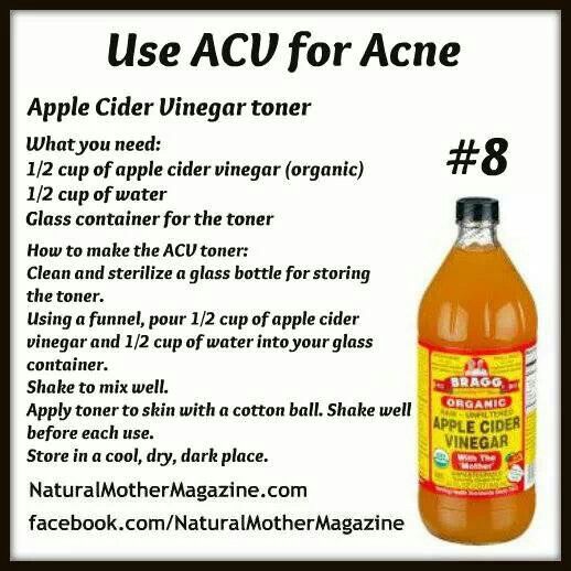 ACV facial toner Acv For Acne, Apple Cider Vinegar Toner, Apple Cider Vinegar Acne, Apple Cider Vinegar Uses, Apple Cider Vinegar For Skin, Apple Cider Benefits, Skin Remedies, Skin Care Remedies, Skin Cleanser Products