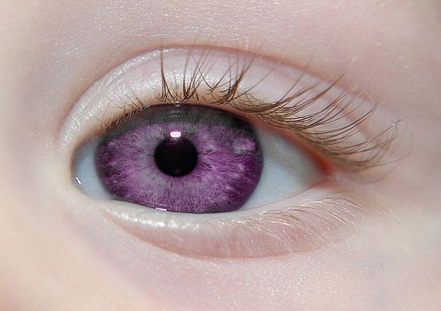 purple eye by Lee251073, via Flickr Alexandria Genesis, Yennefer Of Vengerberg, Genetic Mutation, Violet Eyes, After Six, 다크 판타지, All Things Purple, Purple Eyes, Elizabeth Taylor