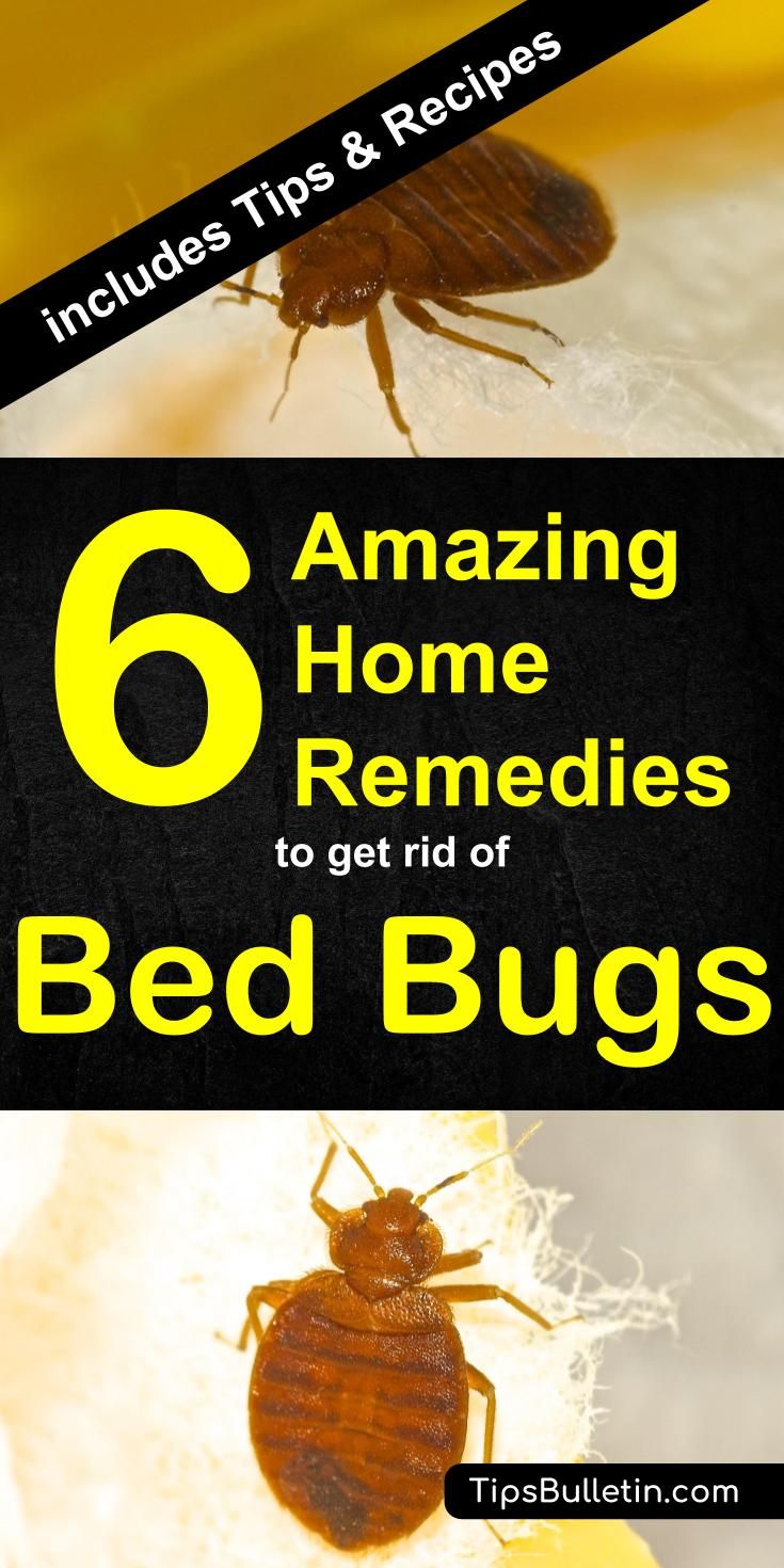 Have bed bugs? Want to keep them from living in your home without spending a fortune on an exterminator? Check out these quick home remedies for bed bugs. Bed Bug Remedies, Get Rid Of Bed Bugs, Kill Bed Bugs, Rid Of Bed Bugs, Bed Bug, Deep Cleaning Tips, Baking Soda Uses, Baking Soda Shampoo, Amazing Home