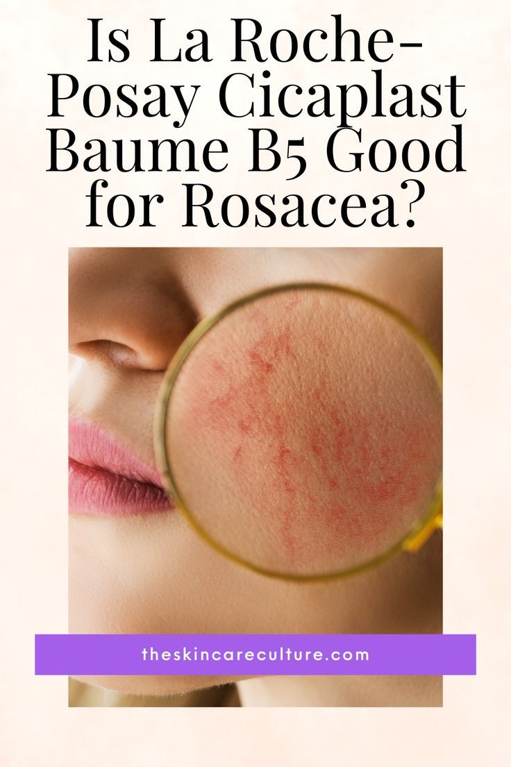 Cicaplast Baume B5 is a powerful solution for those suffering from rosacea. Its blend of soothing, calming, and repairing ingredients can provide significant relief for the symptoms of this condition. In this article, we will delve deeper into the topic of rosacea - what it is, how to manage its symptoms, and how incorporating Cicaplast Baume B5 into your skincare routine can make a positive impact Cetaphil Acne, Painful Acne, Cicaplast Baume B5, Different Types Of Acne, Bad Acne, Pimples Remedies, Natural Acne, Types Of Acne, Anti Aging Eye Cream