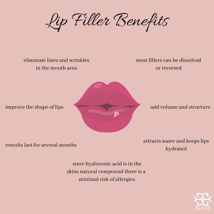 Lip Filler Quotes, Filler Photos Instagram, Cosmetics Quotes, Botox Quotes, Filler Quotes, Cosmetic Fillers, Lips Inspiration, Hyaluronic Acid Fillers, Filler Photos