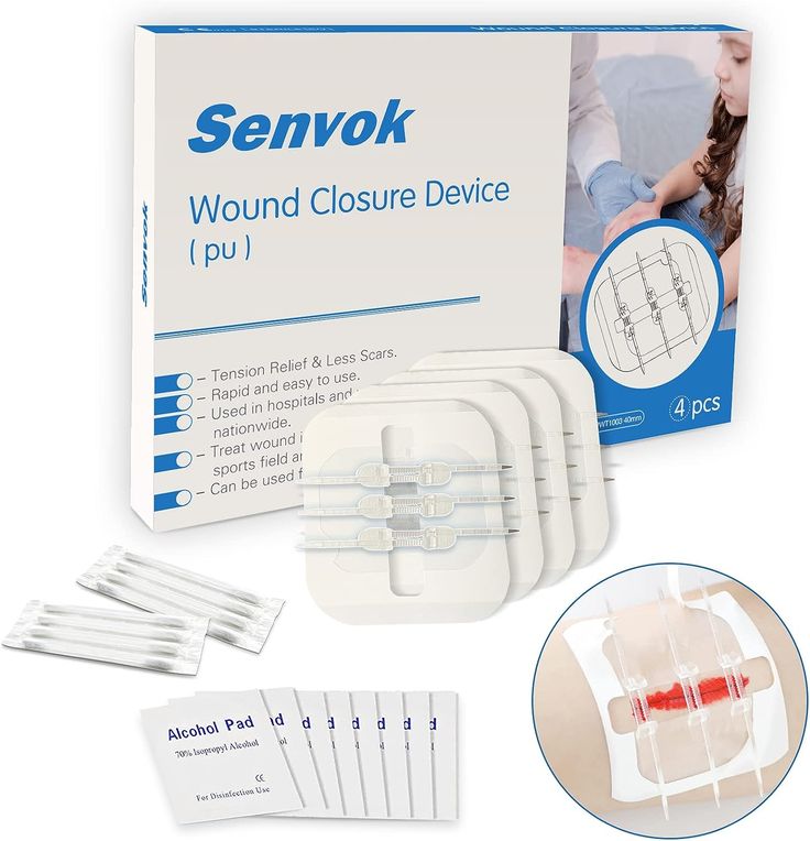 Wound Closure Strips - 4 Pcs Butterfly Bandaids Extra Large Emergency Laceration Closures Kits Bandages for Big Wound Care, Hospital Grade Rapid Skin Closure for Home, Outdoor Tension Relief, Care Hospital, Wound Care, Home Outdoor, First Aid, Natural Health, Backpacking, Extra Large, Medical