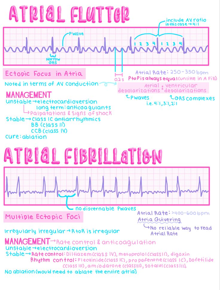 an info sheet with the words atrialal fibrilation written in pink and blue