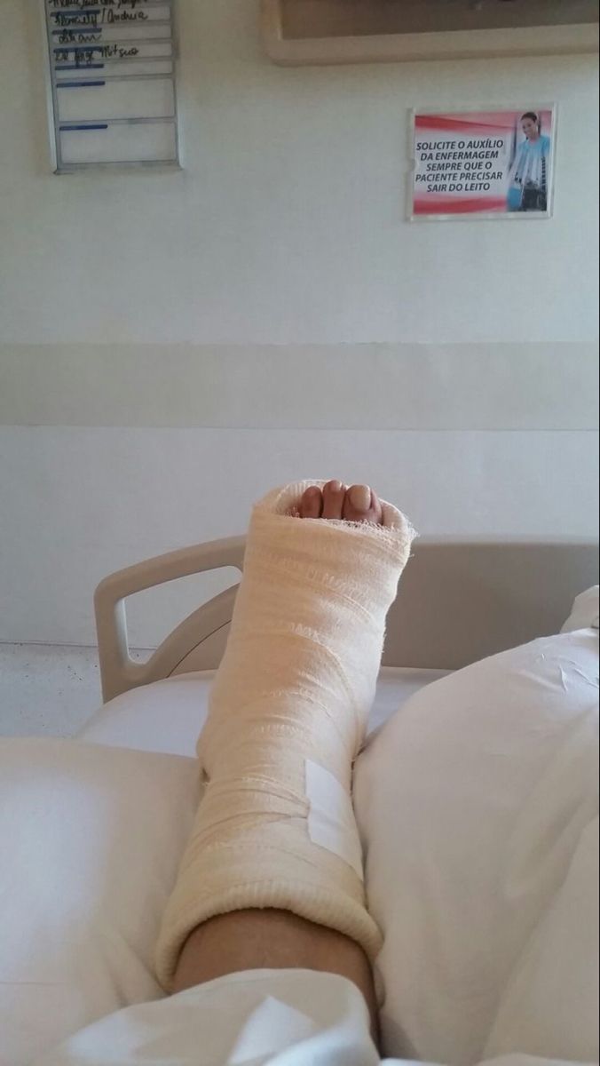 a person with a cast on their leg in a hospital bed