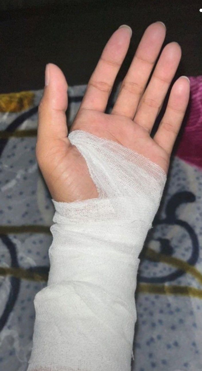 a hand with bandages on it and a pink object in the background