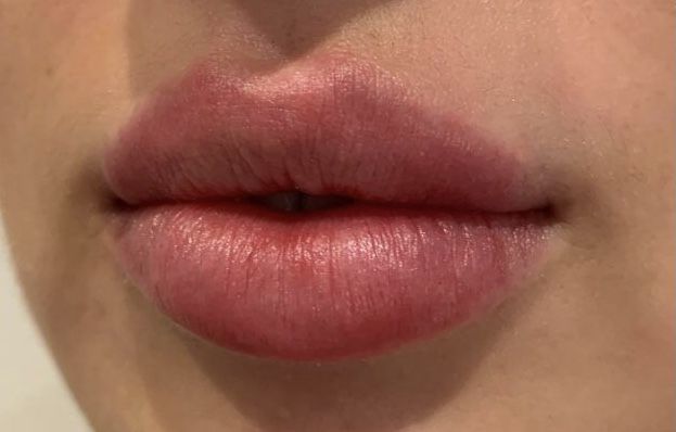 Lip Filler Shape Ideas Black Women, Natural Plump Lips Aesthetic, Lips Aethstetic, Desired Face Inspiration, Perfect Lips Aesthetic, Big Lips Aesthetic, Subliminal Aesthetic, Desired Lips, Desired Face