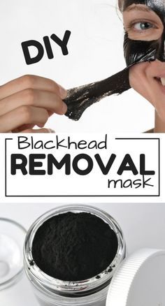 DIY Blackhead removal mask to get rid of blackheads most effectively Mask For Blackheads, Blackhead Removal Mask, For Blackheads, Face Mask For Blackheads, Black Head Remover Mask, Blackheads On Nose, Rid Of Blackheads, Cold Sores Remedies, Blackhead Removal