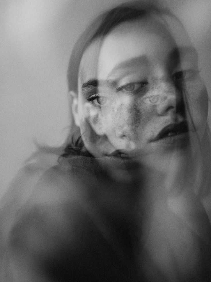 black and white photograph of a woman's face with freckles on it