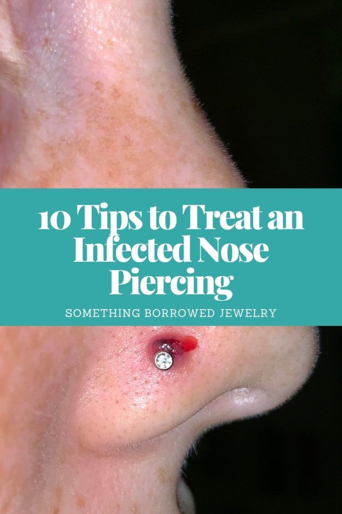 a nose with the words, 10 tips to treat an infered nose piercing