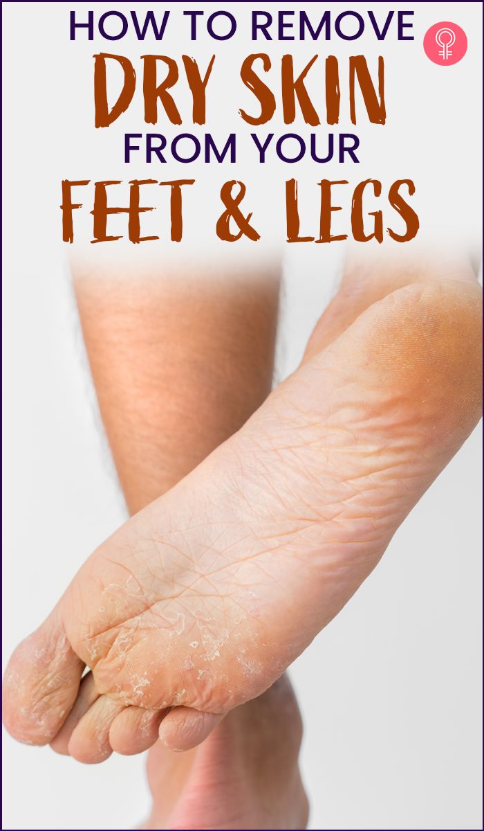 Your feet require your little attention and pampering during winter. So, how to heal cracked feet overnight? Well, just with simple tips and tricks foot care home remedies you can have amazingly soft and smooth feet even during winters. #crackedheels #feetcare Dead Skin On Feet Removal, Dry Feet Remedies, Dead Skin Removal, Dry Flaky Skin, Foot Soak, Thick Skin, Cracked Heels, Cracked Skin, Peeling Skin