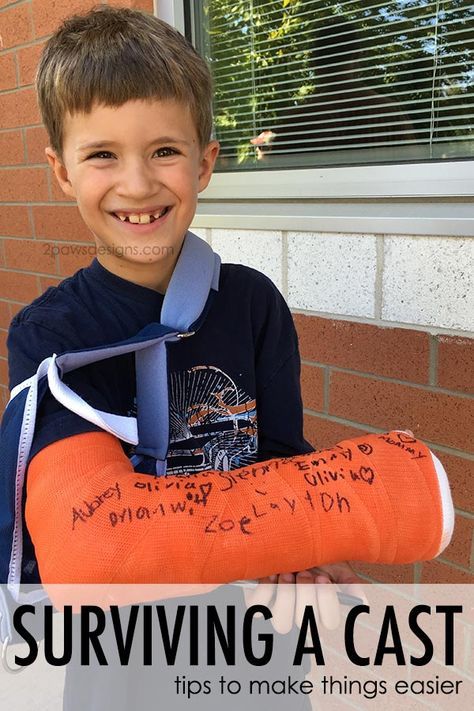 Broken arm? Here are our tips for surviving a cast and making life a little easier while waiting on the bones to heal. Cast Drawing Ideas Arm, Broken Arm Cast, Broken Arm Gift, Cast Covers Arm, Signing Ideas, Cast Decoration, Cast Drawing, Kids Cast, Long Leg Cast