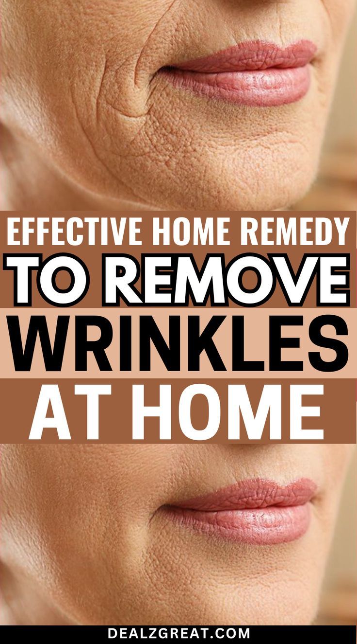 Effective Overnight Home Remedy To Remove Wrinkles Home Remedies For Wrinkles, Regular Skin Care Routine, Homemade Garden, Wrinkle Remedies, Eliminate Wrinkles, Best Skin Care Routine, Face Wrinkles, Skin Blemishes, Unwanted Hair Removal