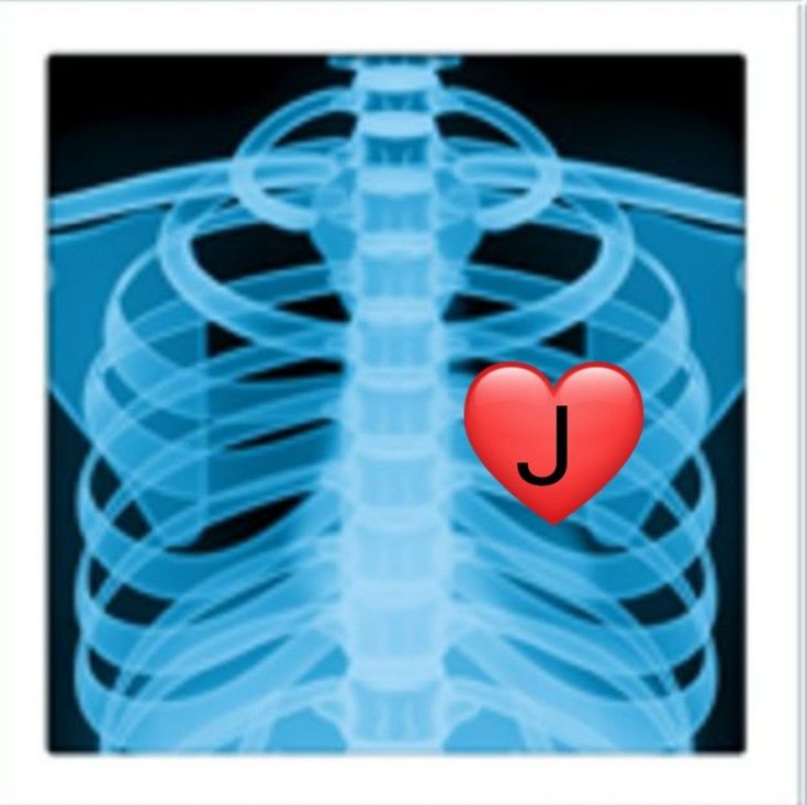 an x - ray image with the letter j on it and a heart in the middle