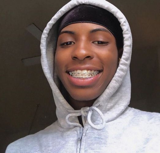 a woman wearing a hoodie and smiling at the camera with braces on her teeth