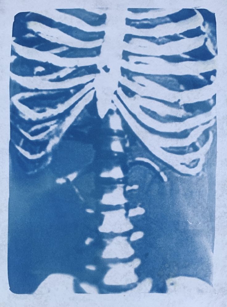 Cyanotype. Cyanotype process. Cyanotype clothing. Cyanotype art. Cyanotype shirt. Cyanotype idea. Cyanotype photography. Cyanotype fabric. Cyanotype aesthetic. 
Spooky Halloween and autumn Cyanotype print of a skeleton on paper. Sun Print Fabric, Cyanotype On Canvas, Cyanotype Tattoo, Cyanotype On Jeans, Cyanotype Art Ideas, Cyanotype Aesthetic, Blue Skeleton Aesthetic, Cynotype Clothes, Cyanotype On Fabric