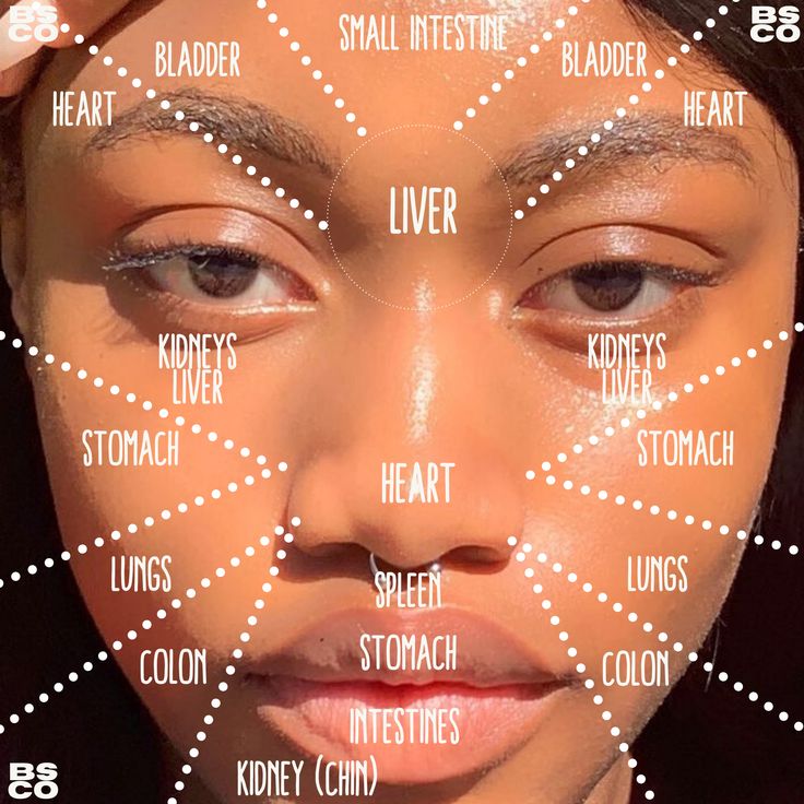 Acne placement associated with the imbalances  in your body? Who knew!? Acne Placement, Facial Acne Map, Acne Location Meaning, Acne Placement Meaning, Acne Map, Acne Chart, Cheek Acne, Acne Facial, Acne Skincare Routine