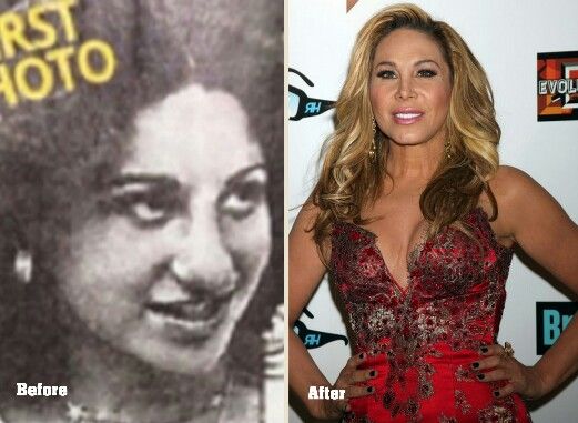 Adrienne  Maloof ... Adrienne Maloof, Botox And Fillers, Celebrity Plastic Surgery, Under The Knife, Nose Job, Born This Way, After Photos, Real Housewives, Plastic Surgery