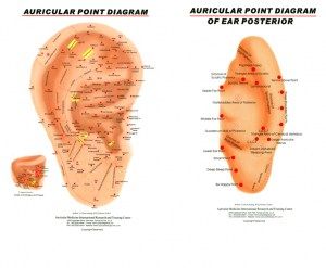 Books : Auricular Chart - Right Ear Ear Seed Placement, Evergreen Herbs, Ear Seeds, Insomnia, Medical Supplies, Seeds, Books, Color