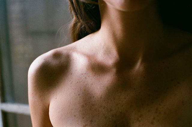 a close up of a woman's breast with frecks on her chest