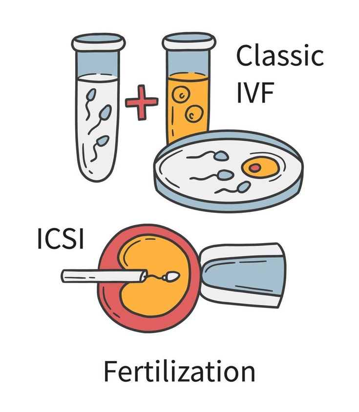 In Vitro fertilization IVF and Intracytoplasmic sperm injection ICSI In Vitro Fertilization, Petri Dish, In Vitro, Styled Stock, Photos Ideas, Fertility, Biology, Vector Illustration, How To Draw Hands