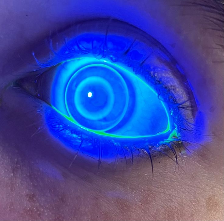 the iris of an eye is glowing blue