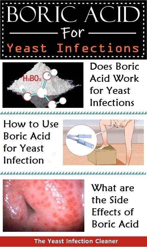 Boric Acid For Yeast Infection, Boric Acid Suppositories, Candida Yeast Infection, Yeast Infection Symptoms, Basic Anatomy, Traditional Rose, Boric Acid, Basic Anatomy And Physiology, Yeast Infections