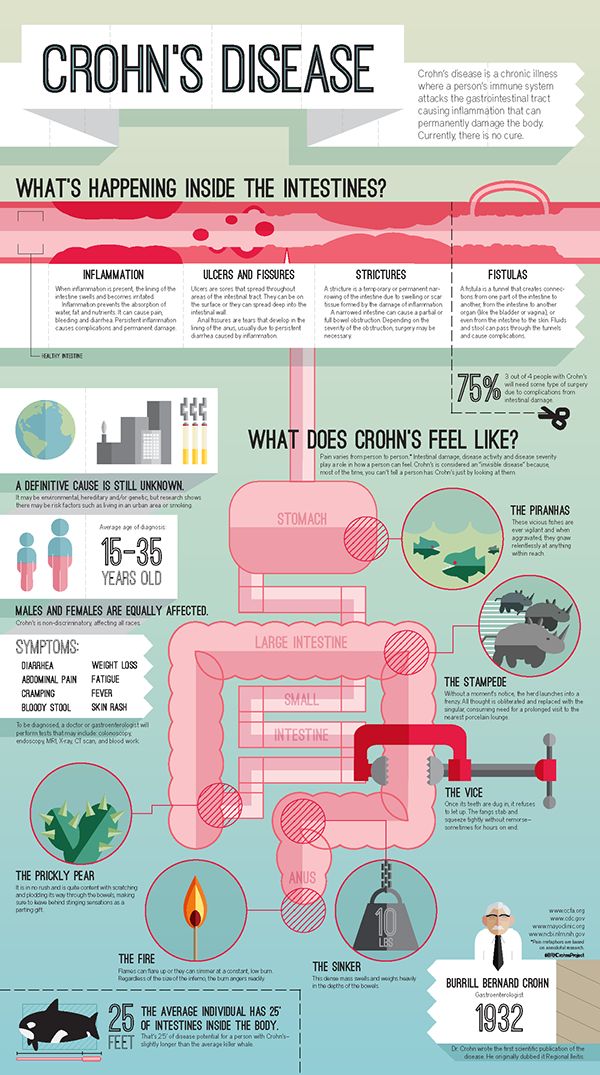 Crohn's Disease - An Infographic. by B. R. Keller, via Behance Chrones Disease, Crohns Diet, Chrons Disease, Crohns Awareness, Chronic Disease, Autoimmune Disease, Migraine, Health Tips, Disease