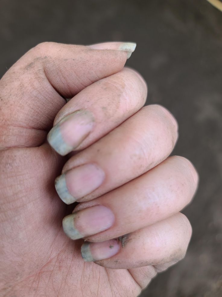 a person holding their hand up to the camera with dirty nails on it's fingers