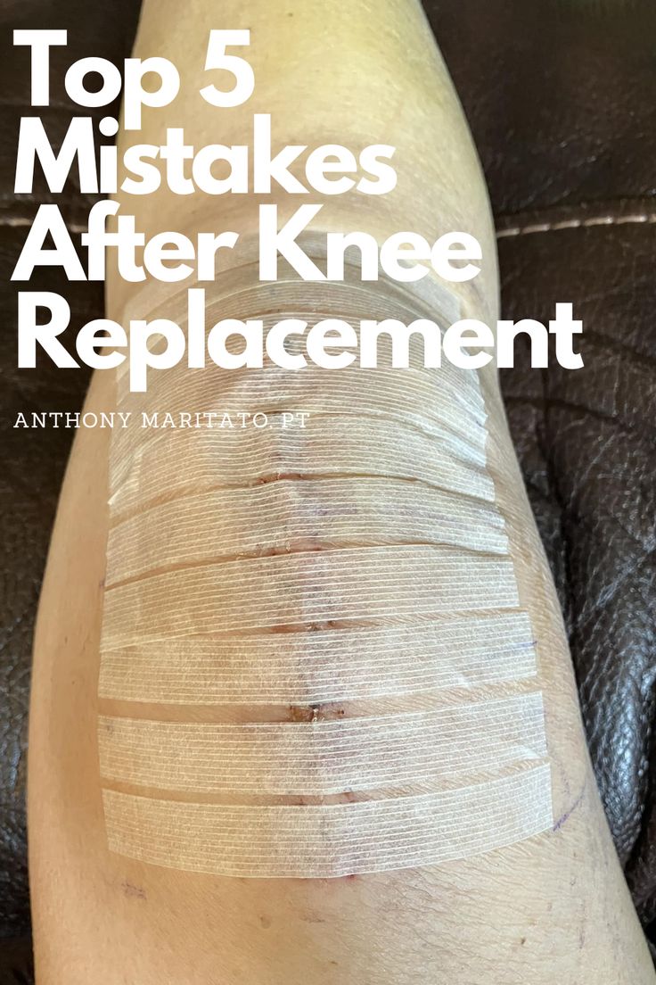 1 week post op total knee replacement Post Op Knee Replacement Exercises, Preparing For Knee Replacement Surgery, Exercise After Knee Replacement, Knee Replacement Recovery Gifts, Exercises After Knee Replacement Surgery, Knee Replacement Recovery Tips, Full Knee Replacement, Knee Replacement Pain, Hyperextended Knee