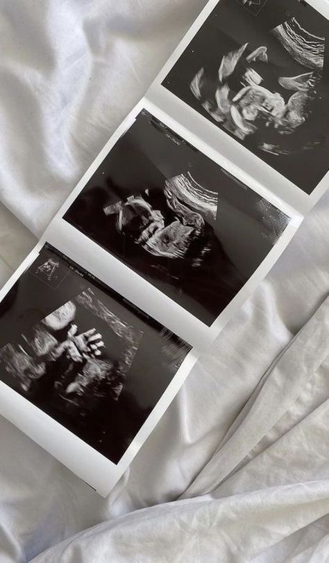 three black and white photographs sitting on top of a bed