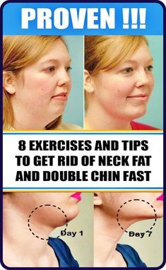 Neck Fat Exercises, Double Chin Exercises, Chin Exercises, Face Yoga Exercises, Face Yoga Facial Exercises, Neck Exercises, Facial Yoga, Face Exercises, Yoga Facial