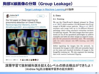 39
胸部X線画像の分類（Group Leakage）
深層学習で放射線科医を超えるレベルの肺炎検出ができたよ！
（Andrew Ng氏は機械学習界の超大御所）
Target Leakage in Machine Learningより抜粋
 