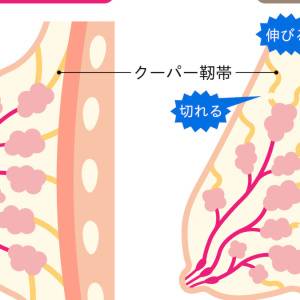 知らないうちに美バストを損なっていませんか？要注意！5つのNG行動