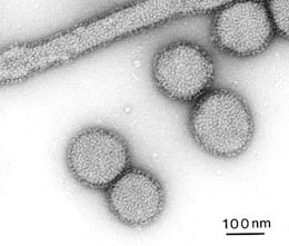 〈資料写真〉インフルエンザウイルスの電子顕微鏡像（国立感染症研究所ホームページより）