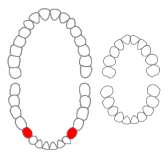 Mandibular first premolars01-01-06.png