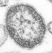 Measles virus.JPG