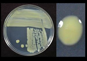 Xanthomonas Culture.jpg