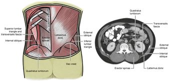 LumbarTriangle.jpg