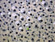 Frogspawn