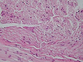 Peripheral nerve, cross section.jpg