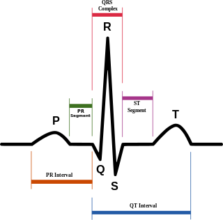 SinusRhythmLabels.svg