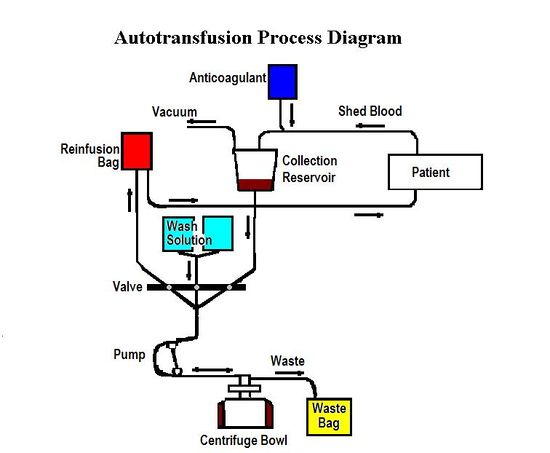 AUTOTRANSFUSIONPD.JPG