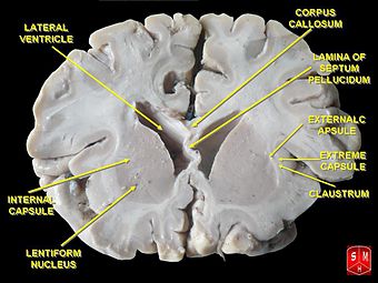 Basal ganglia 1.jpg