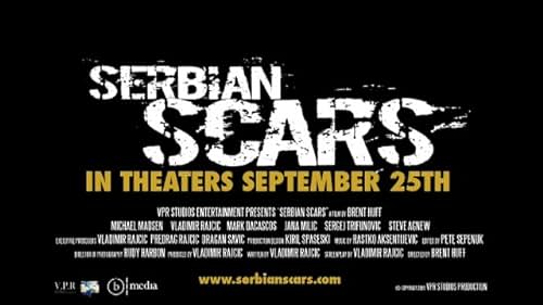 Serbian Scars