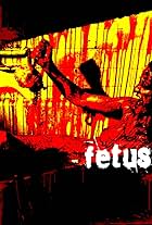 Fetus