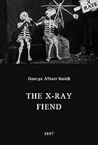 The X-Ray Fiend