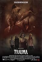 Trauma