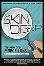 Skin Deep: The Battle Over Morgellons (2019)